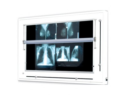 Mammography viewers 