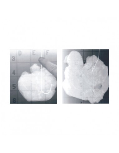 Radiopaque grid 30mm thick VVX3P transport of breast surgeon specimen Box of ten with pins Radiopaque grid 30mm thick VVX3P transport of breast surgeon specimen Box of ten with pins