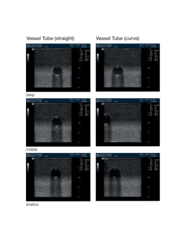 Fantôme de simulation pour introduction accès vasculaire REAL VESSEL sous échographie Fantôme de simulation pour introduction accès vasculaire REAL VESSEL sous échographie