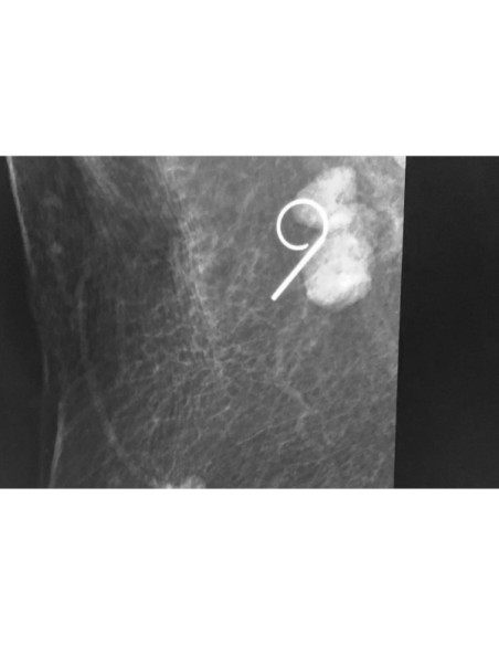 Fil de localisation mammaire repositionnable 19G x 5 cm (bte de 10) Flexibilité unique du crochet rétractable