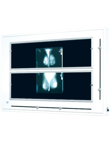 Négatoscope mammographies 12 clichés 18x24 à volets et barre fixe conforme au référentiel ANSM